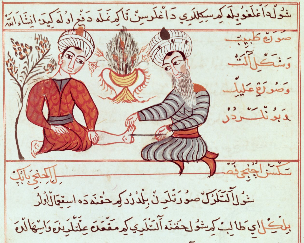Ms Sup Turc 693 fol.125沸騰およびいぼの治療、1466 作： キャラフエディン