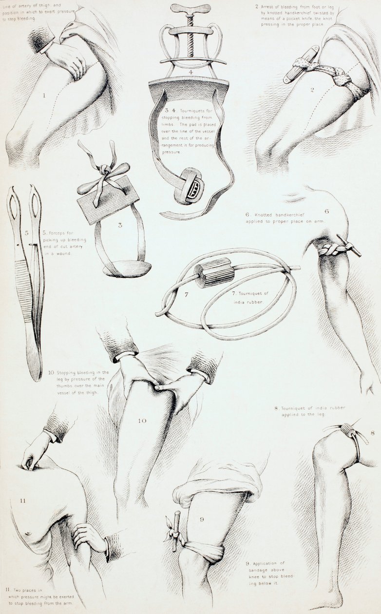 出血を止める方法、c.1890 作： 英語学校