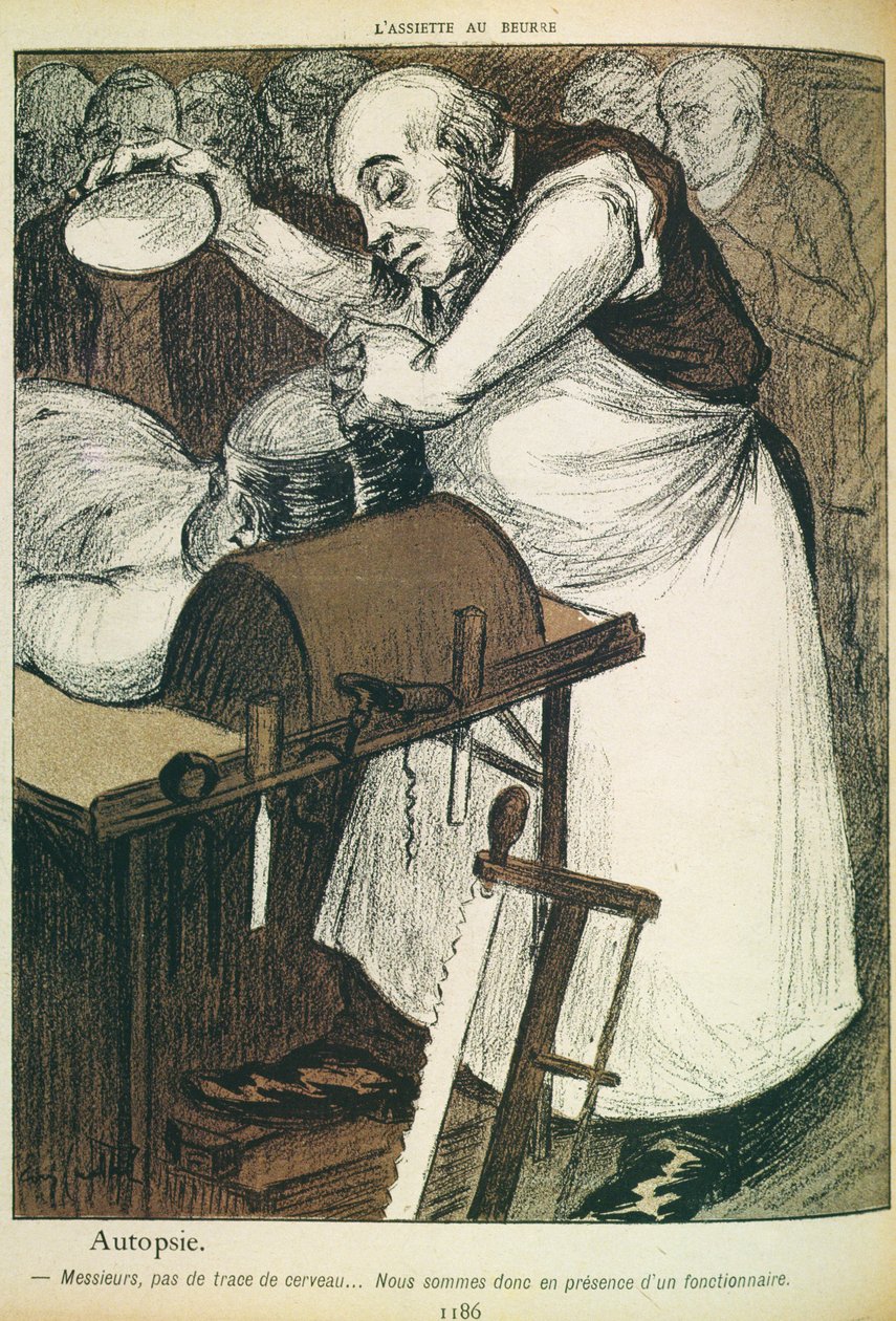 剖検、脳の兆候なし、彼はパブ「L&39;Assiette Au Beurre」の公務員でなければなりません。 1902年8月 作： イブ・カデル