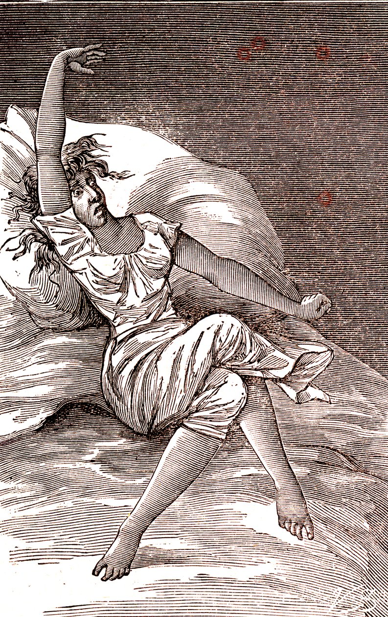 頭痛、メランコリアとヒステリー、不安。1887年（エングレーヴィング） 作： フランス語学校