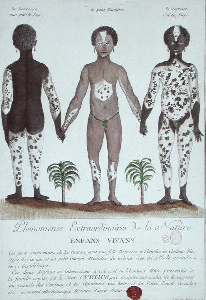 白皮症の現象について 作： フランス語学校