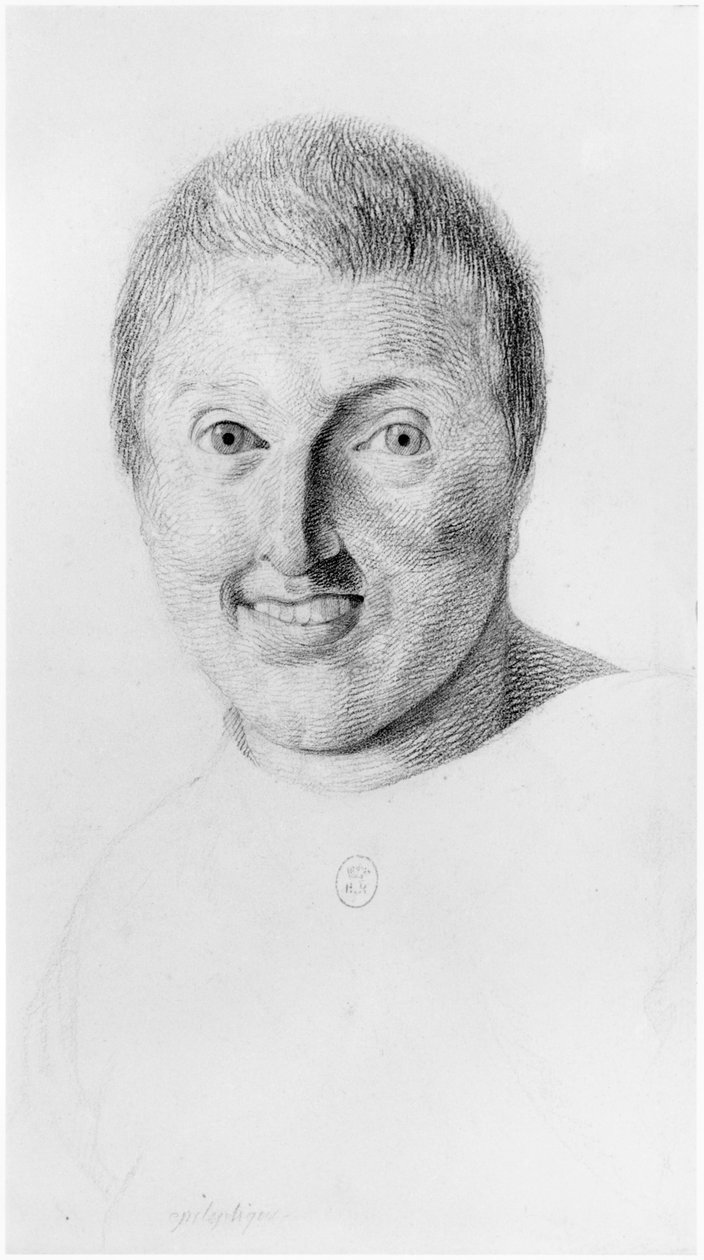 てんかん女性、正面図、サルペトリエール亡命、1818年頃のジャンエティエンヌドミニクエスキロール（1772-1840）による未発表の論文のイラスト 作： ジョルジュ・フランソワ・ガブリエル