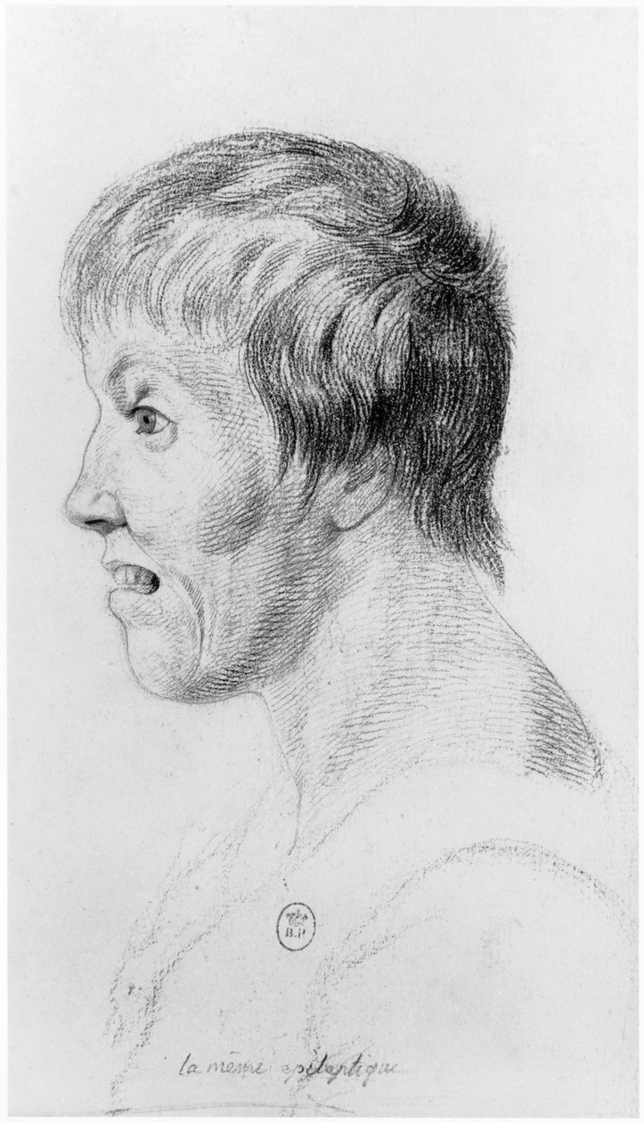 サルペトリエール亡命の狂人学に関するジャンエティエンヌドミニクエスキロール（1772-1840）の未発表論文からのてんかん女性、プロフィール、イラスト、1818年頃 作： ジョルジュ・フランソワ・ガブリエル
