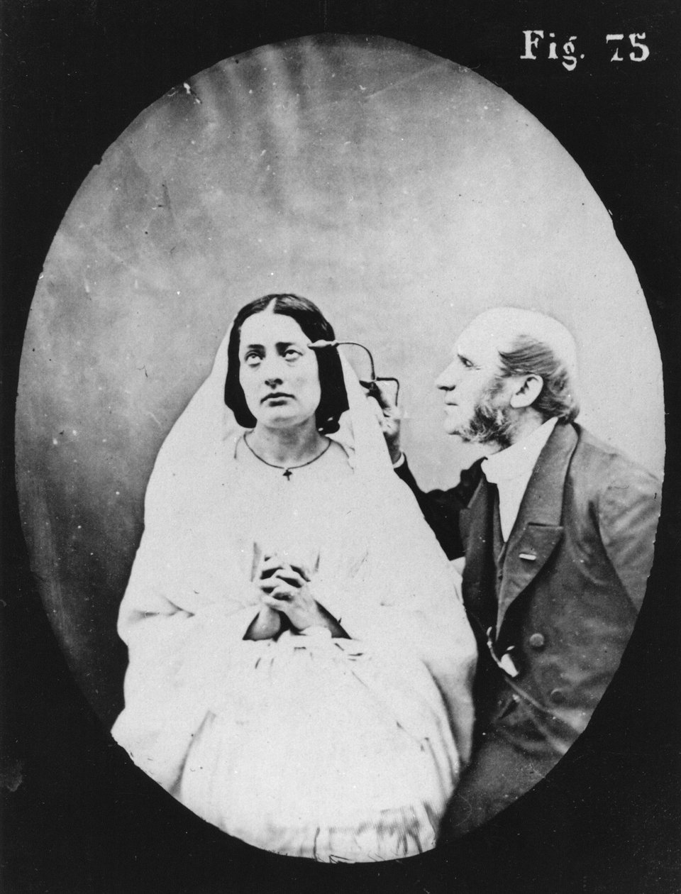 1876年に発行されたパリのデュシェンヌドブローニュによる「Physionomie de la Physionomie humaine ou analyze electrophysiologique des passions」からの生理学的検査 作： ギヨーム・ベンジャミン・アルマン・デュシェンヌ・ド・ブローニュ