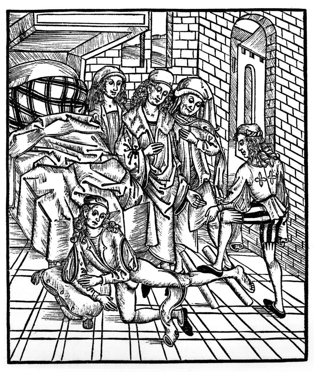 1497年にストラスブールで出版された「ダスブーフデアチルギア」からアシスタントが脚を折ってリセットするように指示する外科医 作： ヒエロニムス・ブランシュヴィヒ