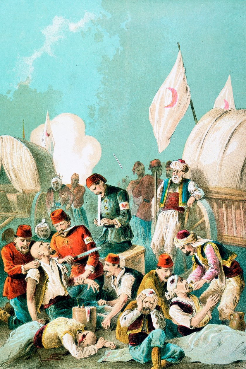 麻酔なしで切断された腕、露土戦争、1877 年 作： 不明
