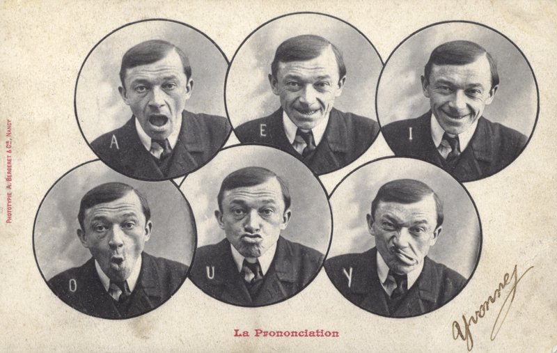 顔を引っ張る男（モノクロ写真 作： フランスの写真家